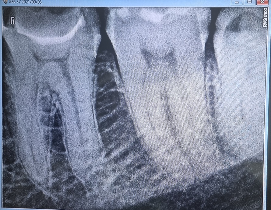 dantys X-ray